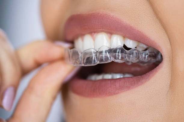 a woman putting on her invisalign